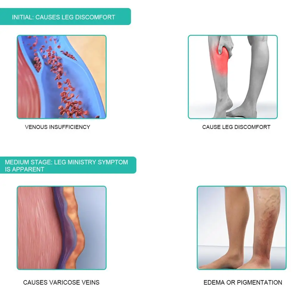 1Pair Medical Compression Sock – обзор и цена Compression Sock Medical